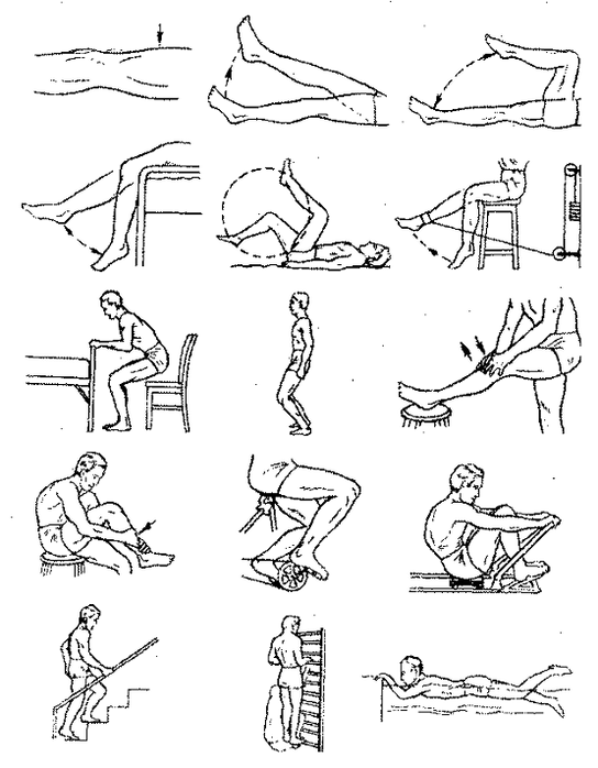 Therapeutische Übungen zur Arthrose des Kniegelenks