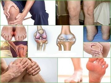 wie man die Entwicklung von Arthritis und Arthrose verhindern