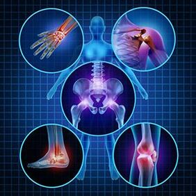 wie man die Mobilität der Gelenke mit Arthritis und Arthrose bei der Behandlung erleichtert