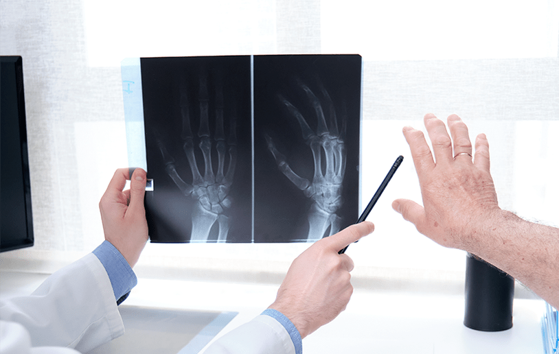 Diagnose einer Gelenkarthrose